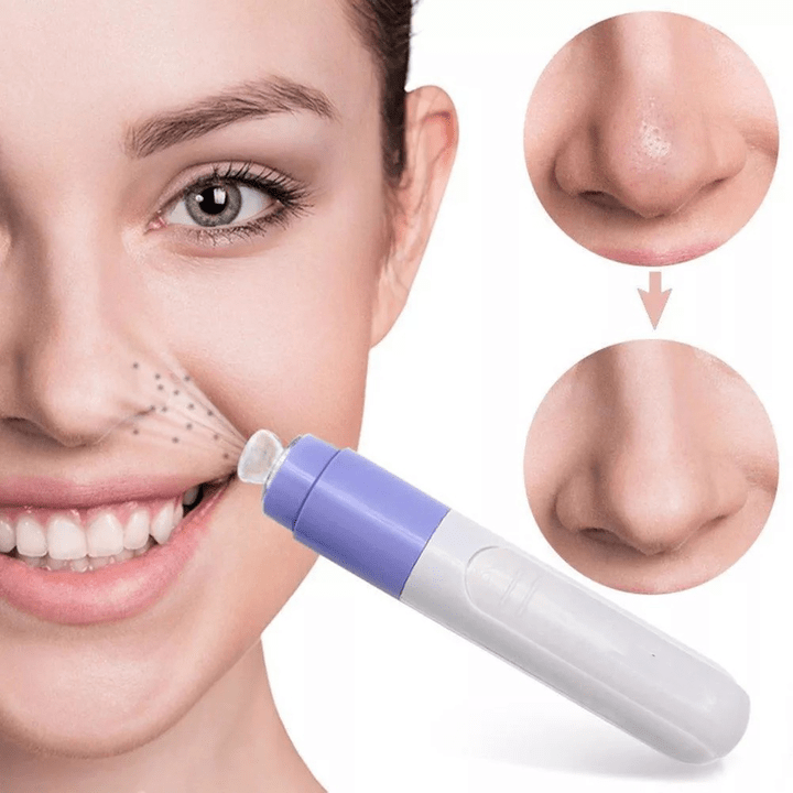 pajisje vakumi për përtëritje të fytyrës
